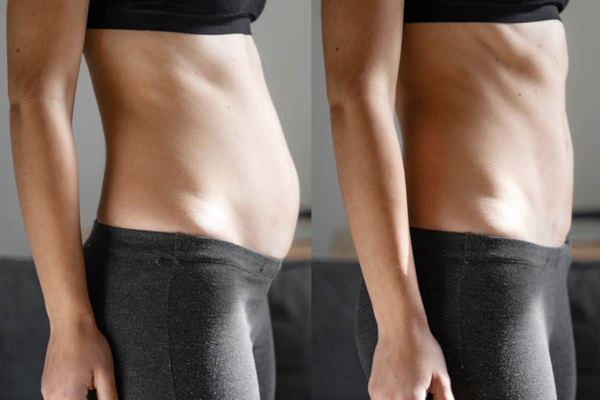 Post-Pregnancy: What Happens to Your Abdominal Muscles After Birth High Wycombe