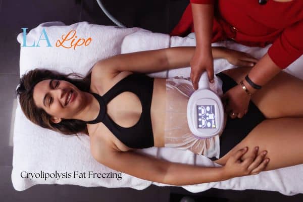 woman getting cryolipolysis High Wycombe
