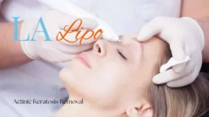 Woman receiving Actinic Keratosis Removal Treatment High Wycombe