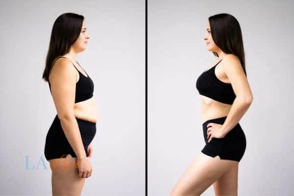LA-EMS Body Sculpting High Wycombe results before and after of womans results on body toning.