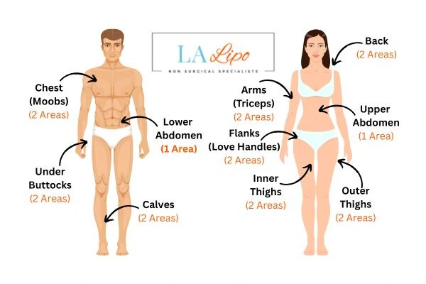 LA LIPO Cryolipolysis Areas High Wycombe