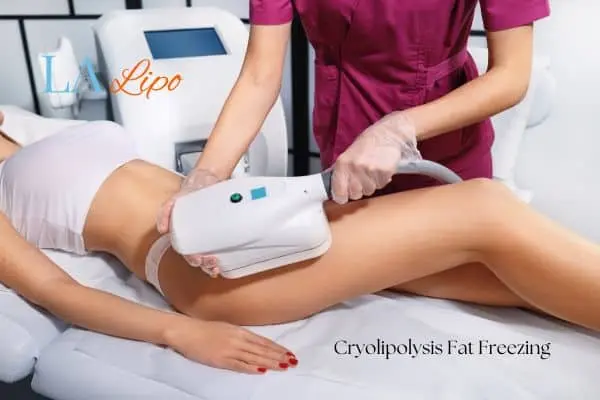 Woman receiving coolsculpting High Wycombe treatment on her thighs