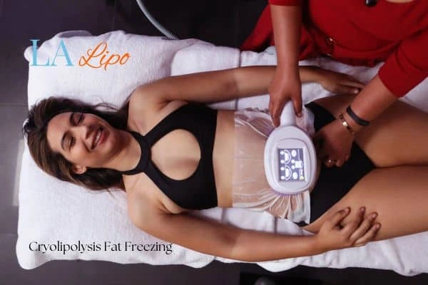 woman getting cryolipolysis High Wycombe