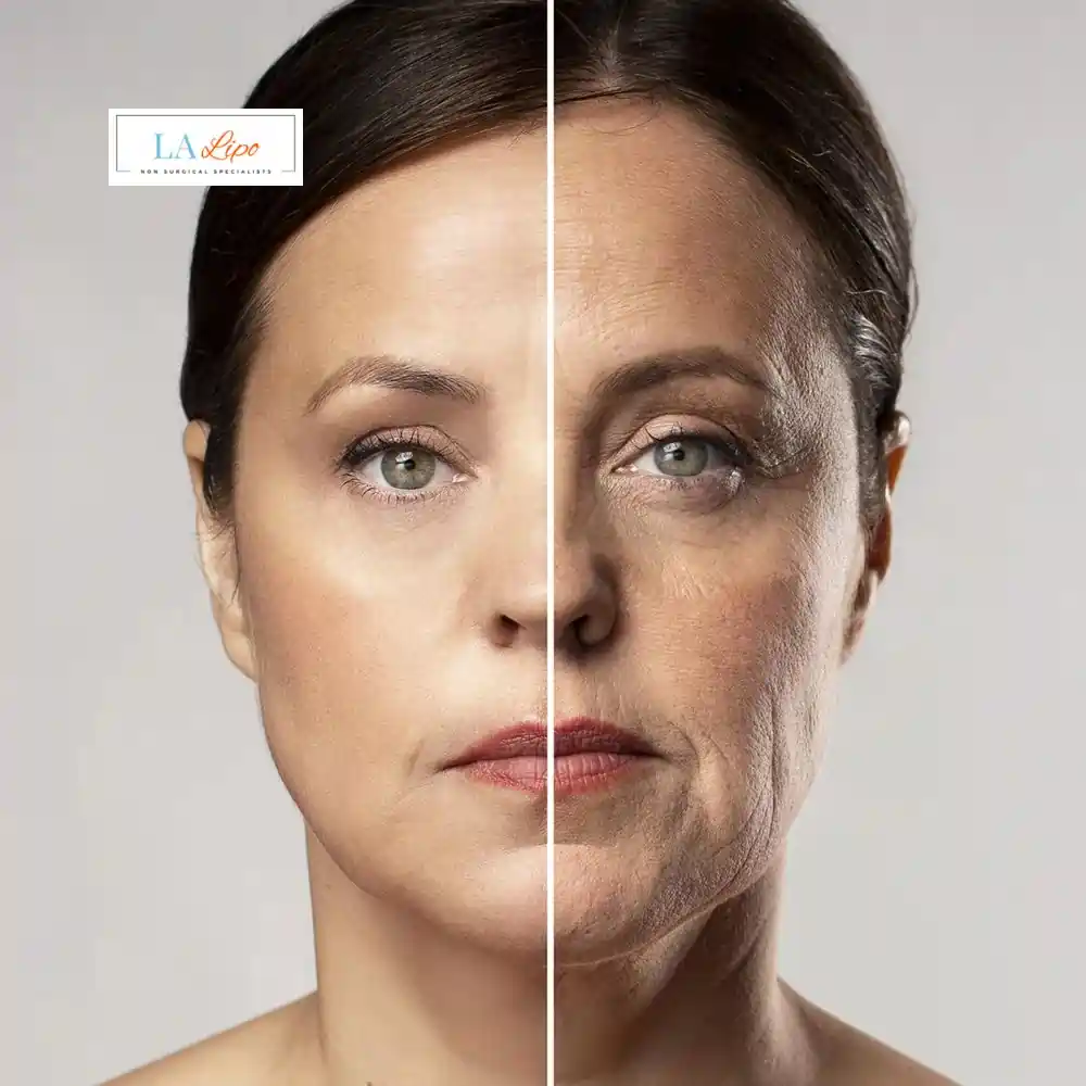 How Can You Tell If Non-Surgical Skin Tightening Is Right for You High Wycombe?