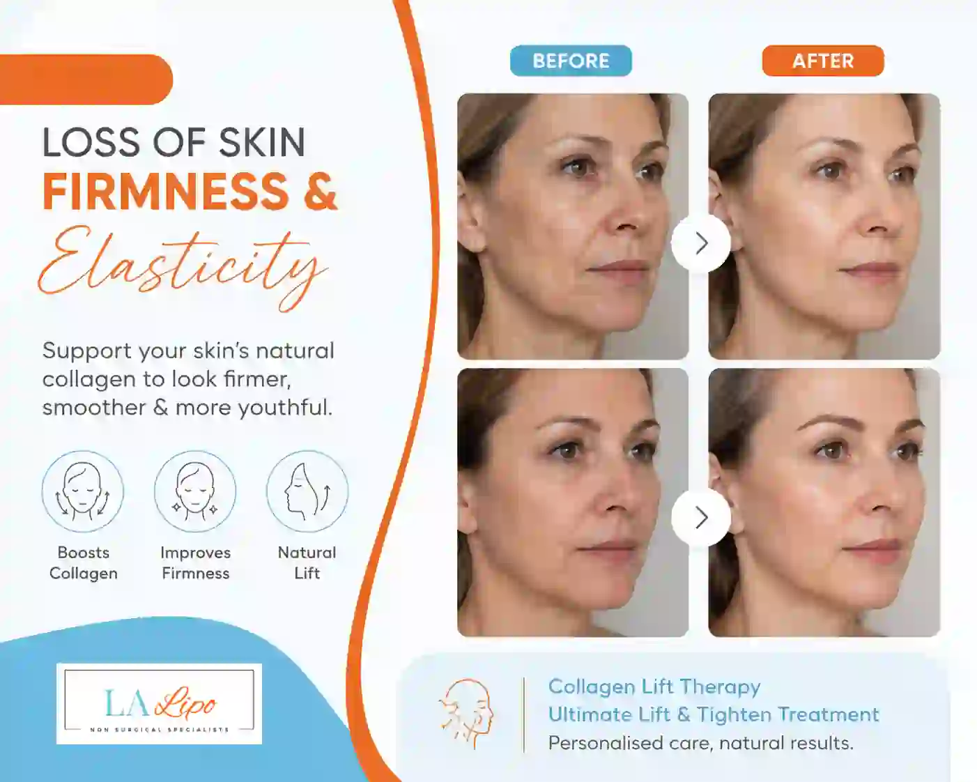 Sign #7: Loss of Skin Firmness and Elasticity High Wycombe