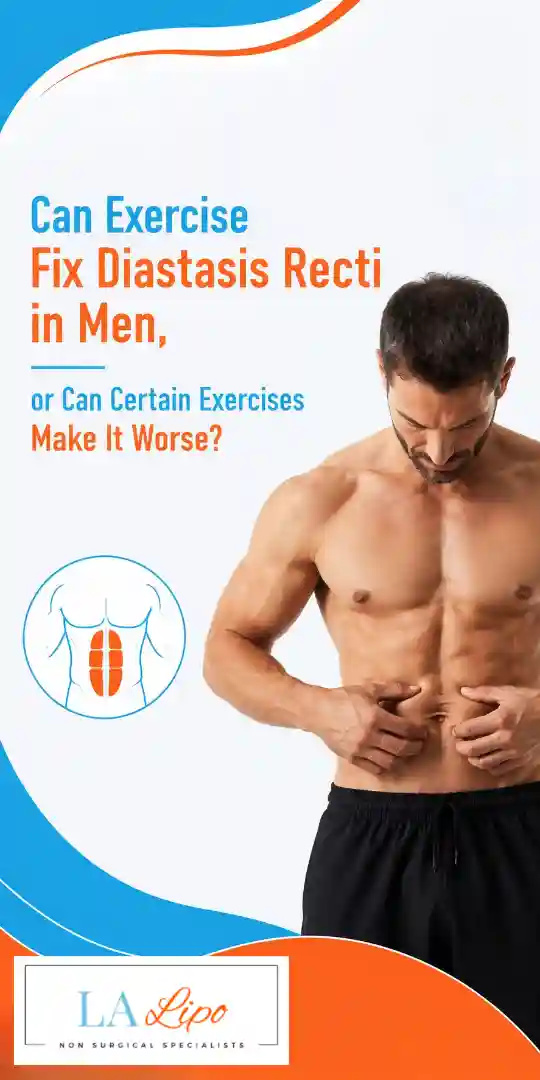 Can Exercise Fix Diastasis Recti in Men, or Can Certain Exercises Make It Worse High Wycombe?